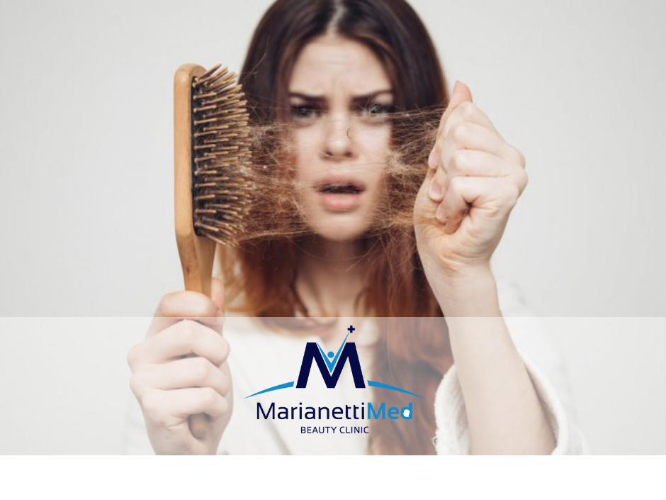 Caduta Capelli Avezzano