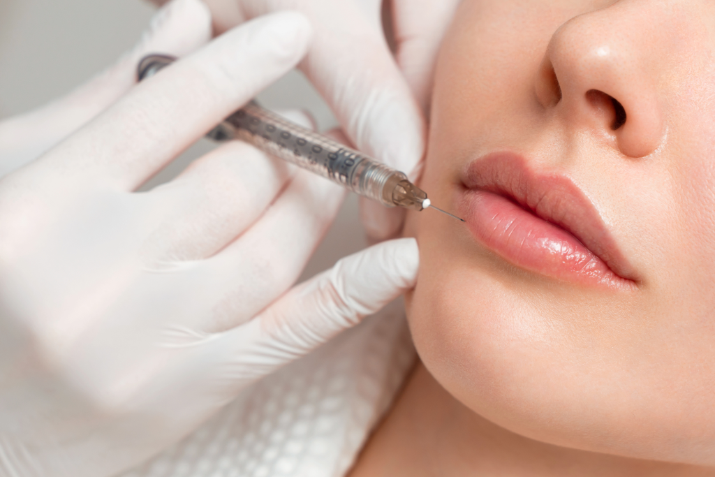 Filler Labbra Avezzano