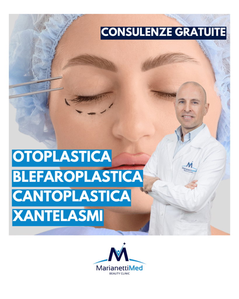 Blefaroplastica Avezzano 2