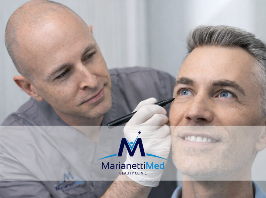 Blefaroplastica Avezzano